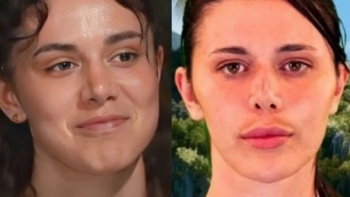 Survivor'a dönen Nefise Karatay'ın son hali gündem oldu - Resim: 4